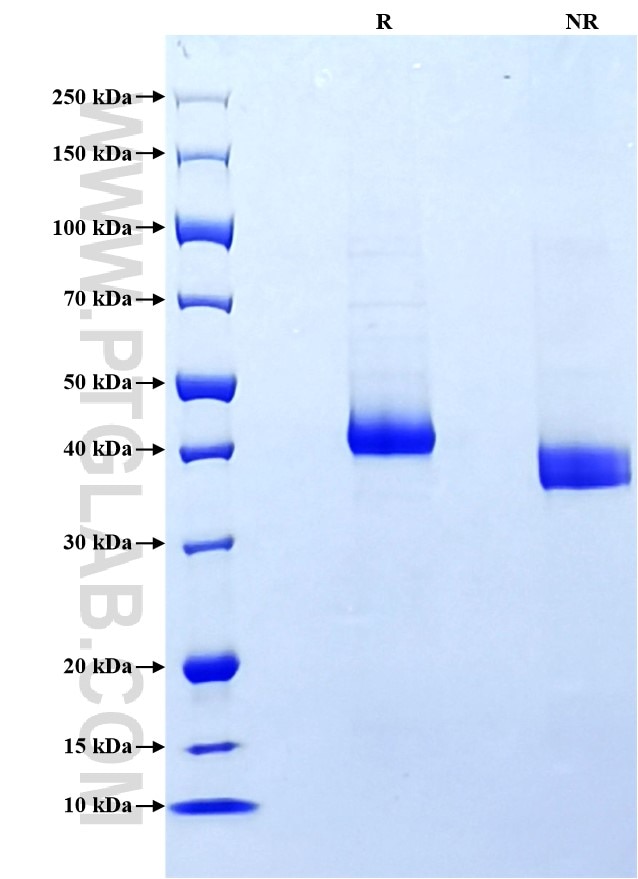 Purity of Recombinant Rabbit CD4 was determined by SDS-PAGE. The protein was resolved in an SDS-PAGE in reducing (R) and non-reducing (NR) conditions and stained using Coomassie blue. Purity of Recombinant Rabbit CD4 was determined by SDS-PAGE. The protein was resolved in an SDS-PAGE in reducing (R) and non-reducing (NR) conditions and stained using Coomassie blue.