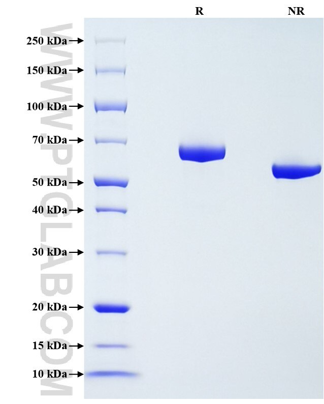 Purity of Recombinant Rat Albumin was determined by SDS-PAGE. The protein was resolved in an SDS-PAGE in reducing (R) and non-reducing (NR) conditions and stained using Coomassie blue.