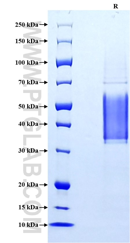 Purity of Recombinant Human HIF-1 alpha was determined by SDS-PAGE. The protein was resolved in an SDS-PAGE in reducing (R) stained using Coomassie blue.