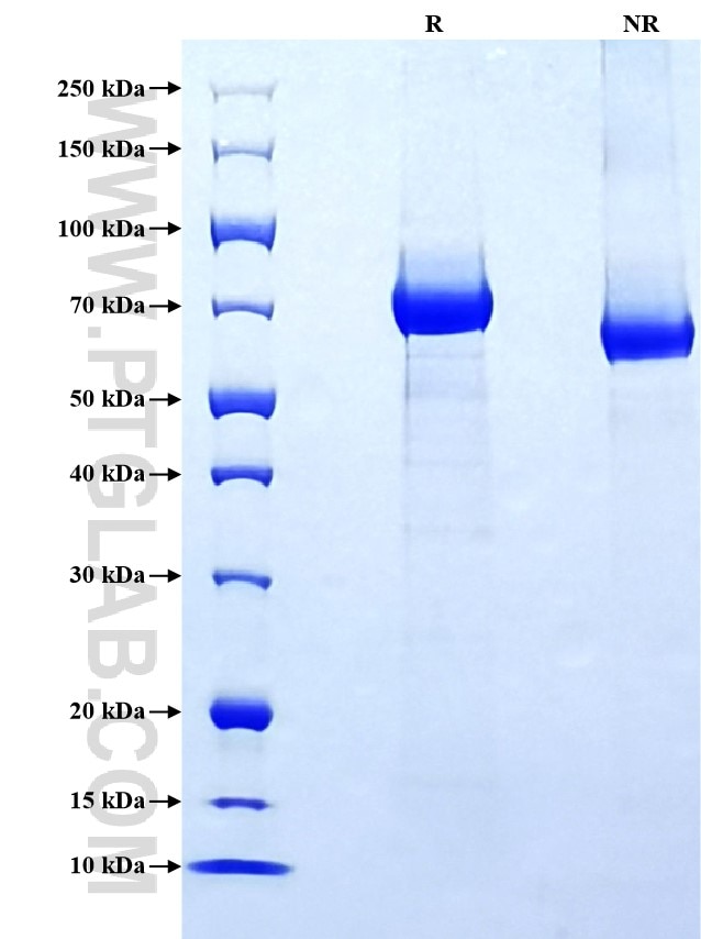 Purity of Recombinant Mouse Coagulation factor II was determined by SDS-PAGE. The protein was resolved in an SDS-PAGE in reducing (R) and non-reducing (NR) conditions and stained using Coomassie blue.