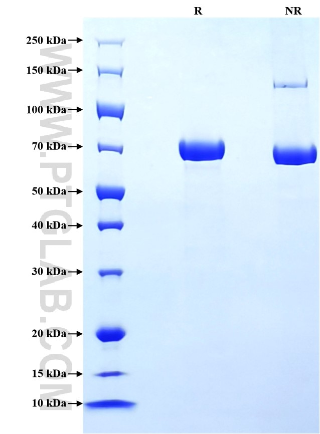 Purity of Recombinant Mouse E-Cadherin was determined by SDS-PAGE. The protein was resolved in an SDS-PAGE in reducing (R) and non-reducing (NR) conditions and stained using Coomassie blue.