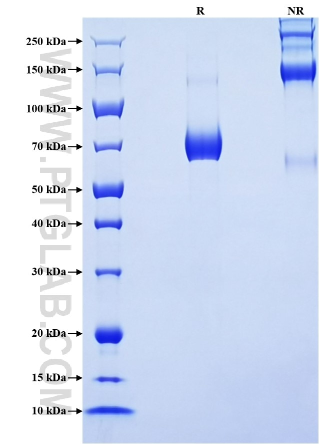 Purity of Recombinant Mouse PD-L1 was determined by SDS-PAGE. The protein was resolved in an SDS-PAGE in reducing (R) and non-reducing (NR) conditions and stained using Coomassie blue. Purity of Recombinant Mouse PD-L1 was determined by SDS-PAGE. The protein was resolved in an SDS-PAGE in reducing (R) and non-reducing (NR) conditions and stained using Coomassie blue.
