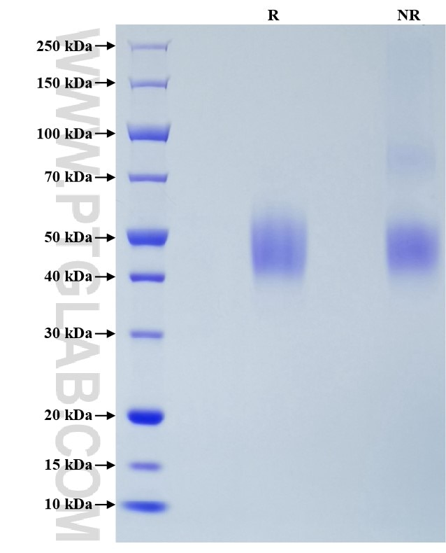 Purity of Recombinant Mouse CD200R1 was determined by SDS-PAGE. The protein was resolved in an SDS-PAGE in reducing (R) and non-reducing (NR) conditions and stained using Coomassie blue. Purity of Recombinant Mouse CD200R1 was determined by SDS-PAGE. The protein was resolved in an SDS-PAGE in reducing (R) and non-reducing (NR) conditions and stained using Coomassie blue.