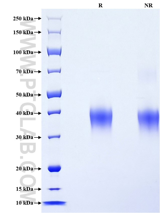 Purity of Recombinant Human CD48 was determined by SDS-PAGE. The protein was resolved in an SDS-PAGE in reducing (R) and non-reducing (NR) conditions and stained using Coomassie blue.