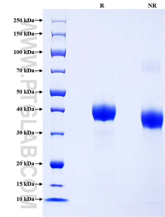 Purity of Recombinant Human Cathepsin B was determined by SDS-PAGE. The protein was resolved in an SDS-PAGE in reducing (R) and non-reducing (NR) conditions and stained using Coomassie blue.