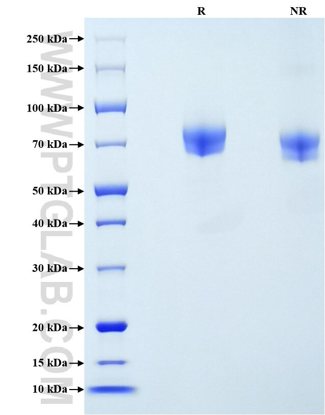 Purity of Recombinant Rat ICAM-1 was determined by SDS-PAGE. The protein was resolved in an SDS-PAGE in reducing (R) and non-reducing (NR) conditions and stained using Coomassie blue.