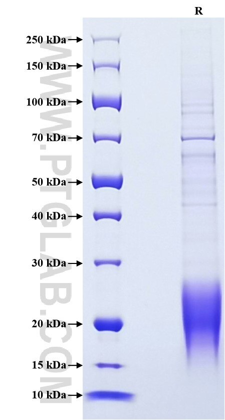 Purity of Recombinant BNP was determined by SDS-PAGE. The protein was resolved in an SDS-PAGE in reducing (R) conditions and stained using Coomassie blue.