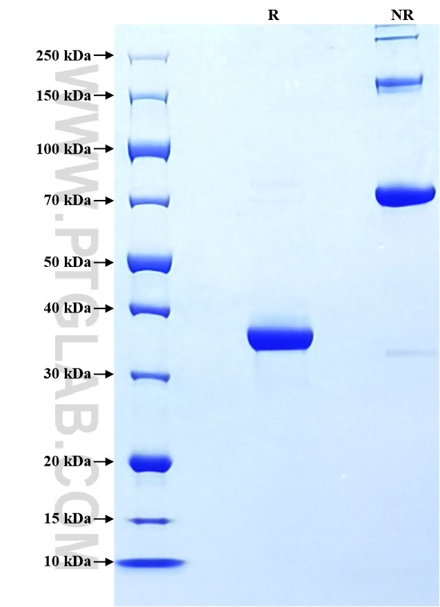 Purity of Recombinant Human CD81 was determined by SDS-PAGE. The protein was resolved in an SDS-PAGE in reducing (R) and non-reducing (NR) conditions and stained using Coomassie blue.