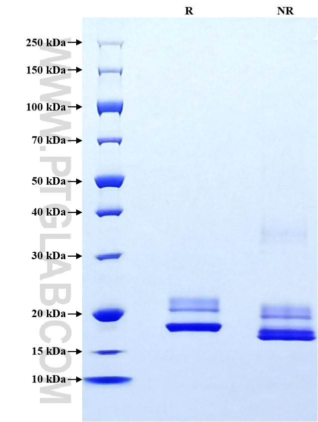 Purity of Recombinant Human SOD1 was determined by SDS-PAGE. The protein was resolved in an SDS-PAGE in reducing (R) and non-reducing (NR) conditions and stained using Coomassie blue.