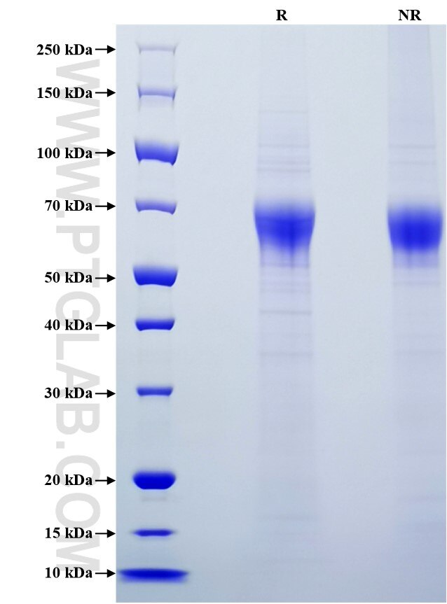 Purity of Recombinant Human Coagulation factor IX was determined by SDS-PAGE. The protein was resolved in an SDS-PAGE in reducing (R) and non-reducing (NR) conditions and stained using Coomassie blue.