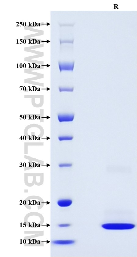 Purity of Recombinant Human Procalcitonin was determined by SDS-PAGE. The protein was resolved in an SDS-PAGE in reducing (R) conditions and stained using Coomassie blue.