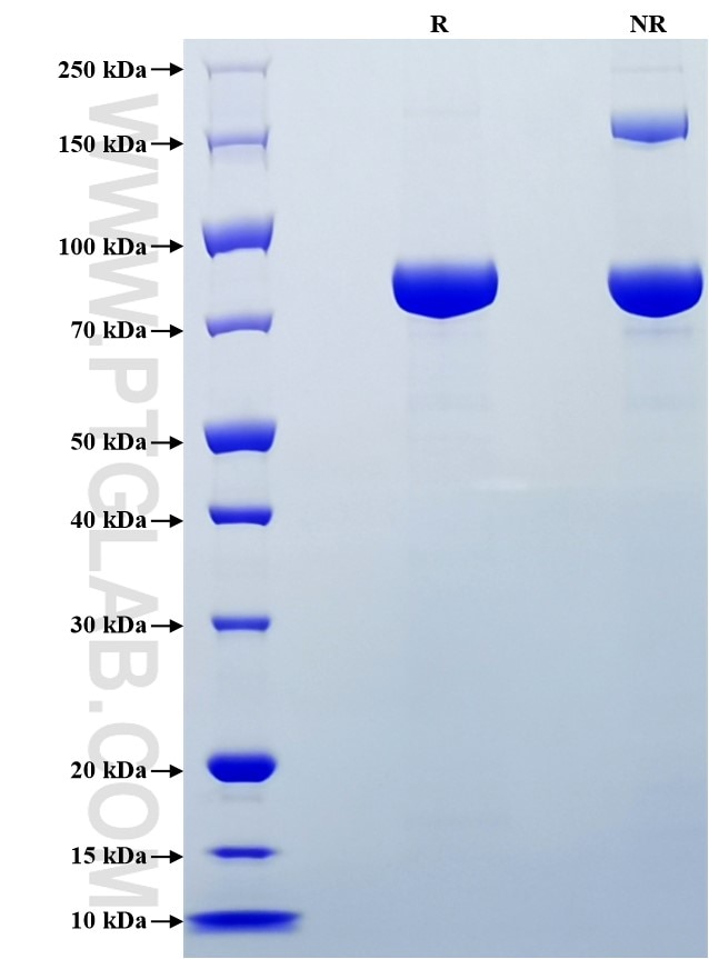 Purity of Recombinant Mouse Transferrin R was determined by SDS-PAGE. The protein was resolved in an SDS-PAGE in reducing (R) and non-reducing (NR) conditions and stained using Coomassie blue.