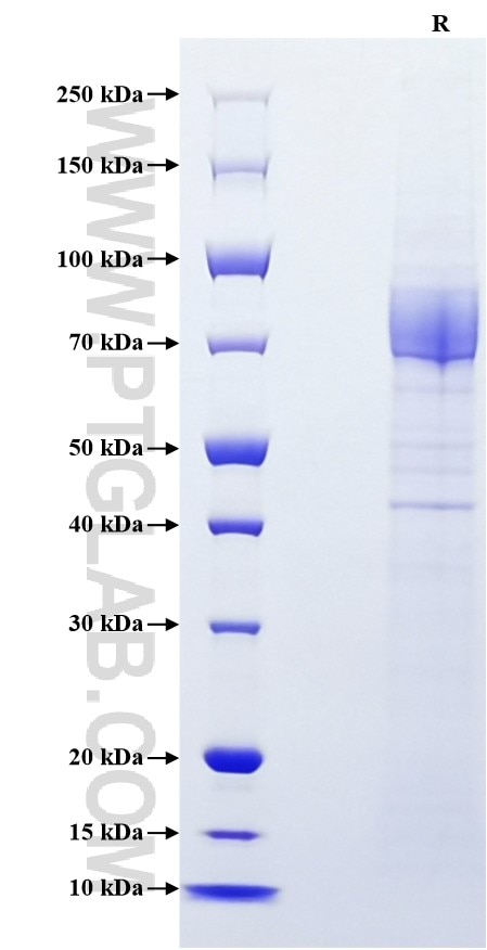 Purity of Recombinant Human CD36 was determined by SDS-PAGE. The protein was resolved in an SDS-PAGE in reducing (R) conditions and stained using Coomassie blue.