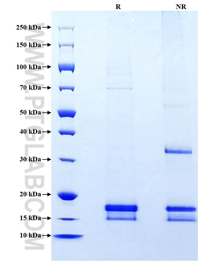 Purity of Recombinant Rat Nppa was determined by SDS-PAGE. The protein was resolved in an SDS-PAGE in reducing (R) and non-reducing (NR) conditions and stained using Coomassie blue. Purity of Recombinant Rat Nppa was determined by SDS-PAGE. The protein was resolved in an SDS-PAGE in reducing (R) and non-reducing (NR) conditions and stained using Coomassie blue.