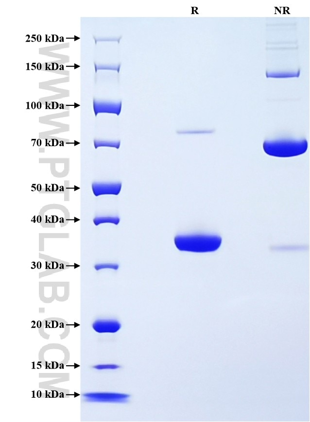 Purity of Recombinant Human CD9 was determined by SDS-PAGE. The protein was resolved in an SDS-PAGE in reducing (R) and non-reducing (NR) conditions and stained using Coomassie blue.