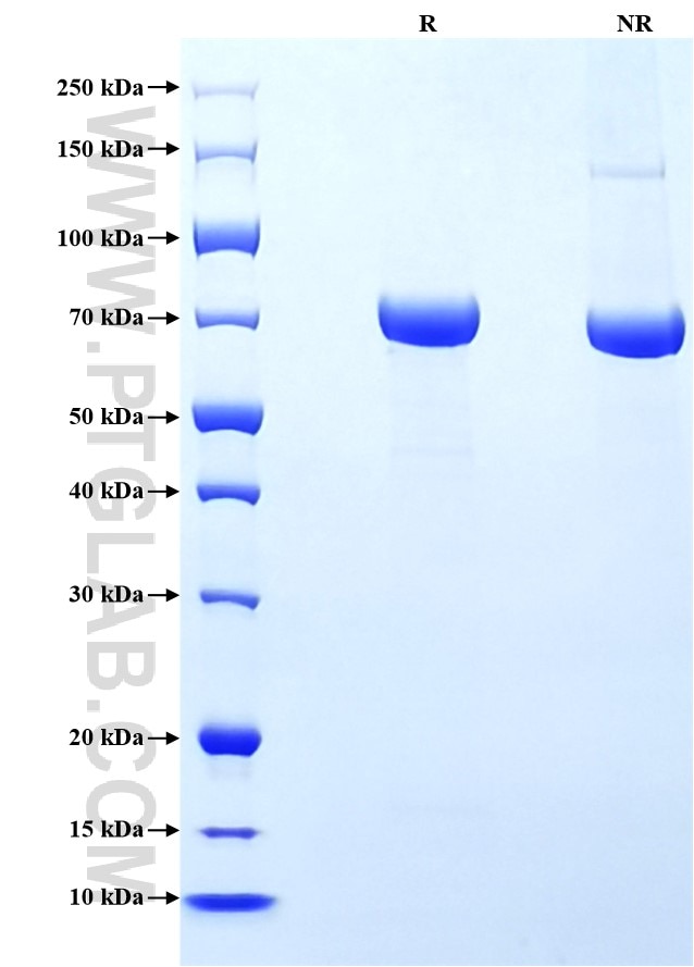 Purity of Recombinant Human E-cadherin was determined by SDS-PAGE. The protein was resolved in an SDS-PAGE in reducing (R) and non-reducing (NR) conditions and stained using Coomassie blue.