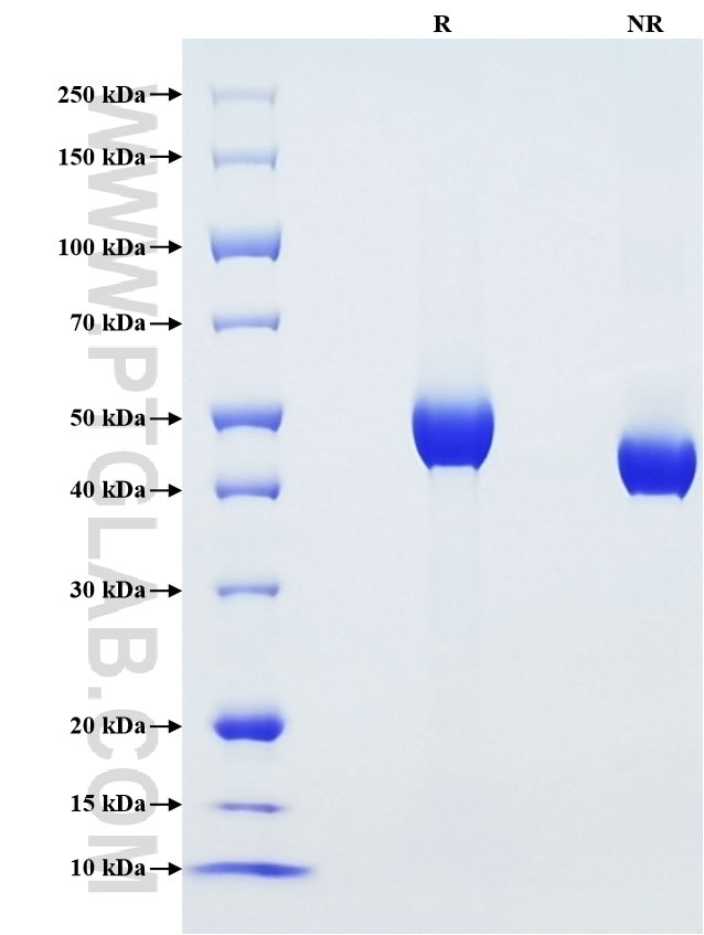 Purity of Recombinant Human CD5 was determined by SDS-PAGE. The protein was resolved in an SDS-PAGE in reducing (R) and non-reducing (NR) conditions and stained using Coomassie blue.