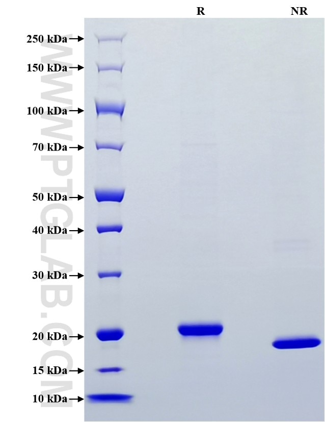 Purity of Recombinant Mouse RBP4 was determined by SDS-PAGE. The protein was resolved in an SDS-PAGE in reducing (R) and non-reducing (NR) conditions and stained using Coomassie blue.
