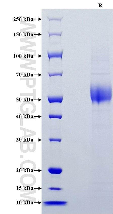 Purity of Recombinant Mouse IL-1 RI was determined by SDS-PAGE. The protein was resolved in an SDS-PAGE in reducing (R) conditions and stained using Coomassie blue.