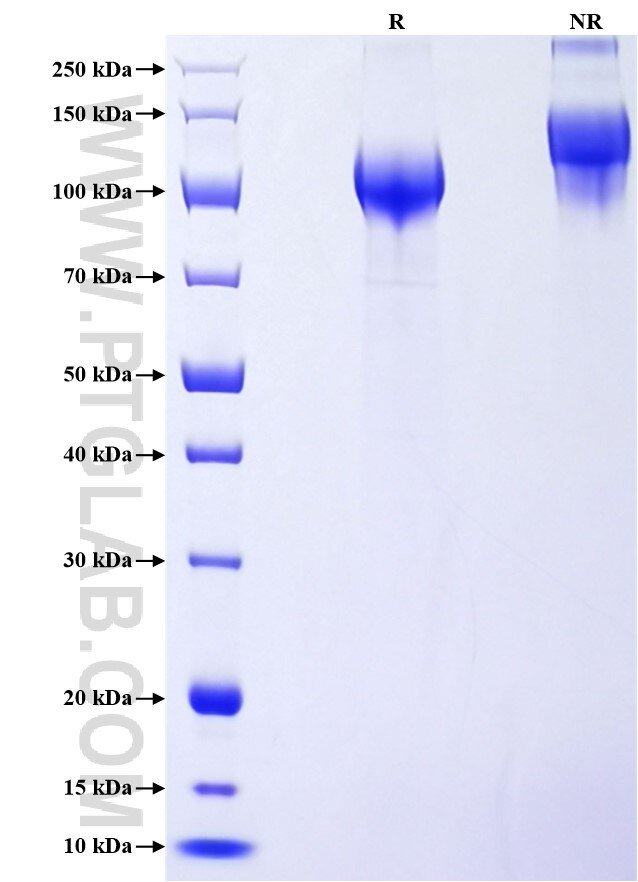 Purity of Recombinant Human Kininogen-1 was determined by SDS-PAGE. The protein was resolved in an SDS-PAGE in reducing (R) and non-reducing (NR) conditions and stained using Coomassie blue.