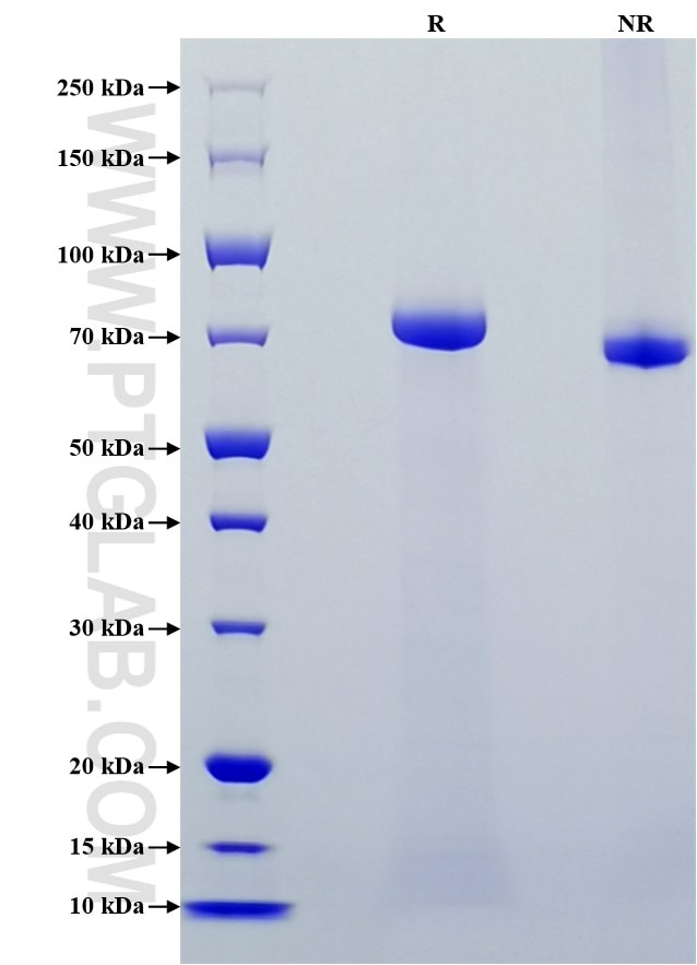 Purity of Recombinant Human Plasma kallikrein/KLKB1 was determined by SDS-PAGE. The protein was resolved in an SDS-PAGE in reducing (R) and non-reducing (NR) conditions and stained using Coomassie blue.