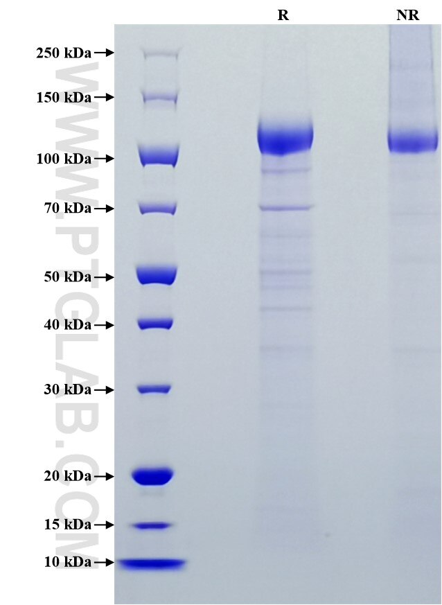 Purity of Recombinant Rat VEGFR1/Flt-1 was determined by SDS-PAGE. The protein was resolved in an SDS-PAGE in reducing (R) and non-reducing (NR) conditions and stained using Coomassie blue.