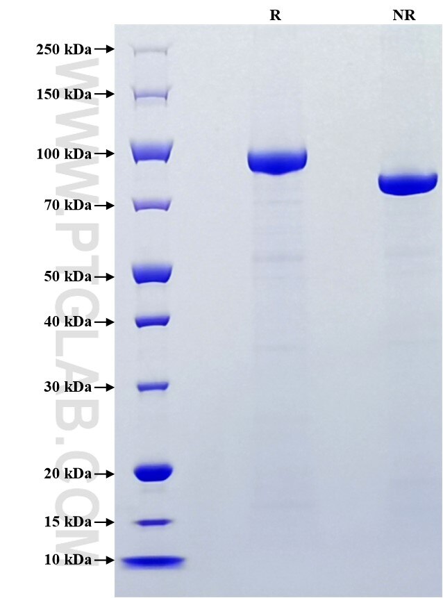 Purity of Recombinant Human Complement component C7/C7 was determined by SDS-PAGE. The protein was resolved in an SDS-PAGE in reducing (R) and non-reducing (NR) conditions and stained using Coomassie blue.