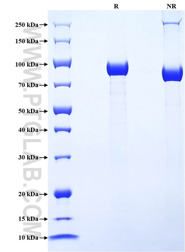 Purity of Recombinant Human Complement factor B was determined by SDS-PAGE. The protein was resolved in an SDS-PAGE in reducing (R) and non-reducing (NR) conditions and stained using Coomassie blue.
