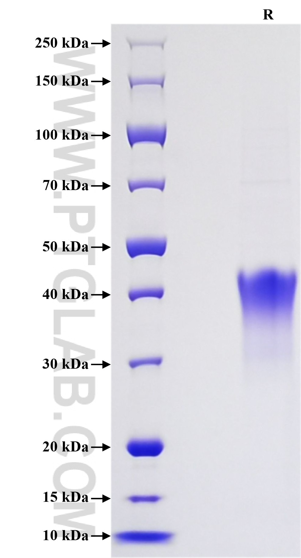 Purity of Recombinant Human CD134 was determined by SDS-PAGE. The protein was resolved in an SDS-PAGE in reducing (R) conditions and stained using Coomassie blue. Purity of Recombinant Human CD134 was determined by SDS-PAGE. The protein was resolved in an SDS-PAGE in reducing (R) conditions and stained using Coomassie blue.