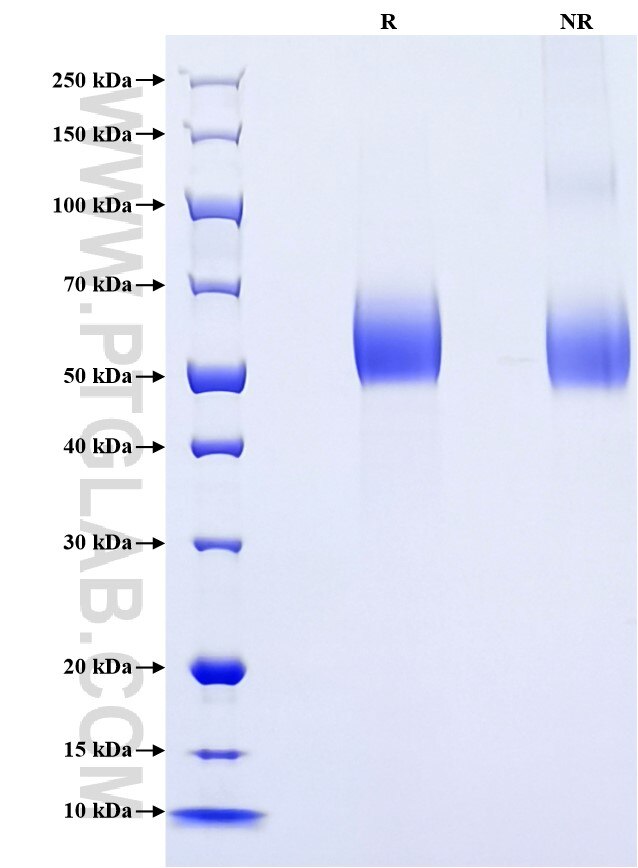 Purity of Recombinant Human FGFR2 was determined by SDS-PAGE. The protein was resolved in an SDS-PAGE in reducing (R) and non-reducing (NR) conditions and stained using Coomassie blue.