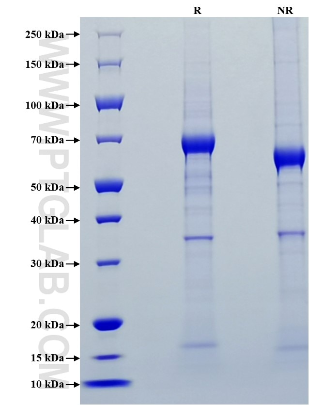 Purity of Recombinant Human Component C9 was determined by SDS-PAGE. The protein was resolved in an SDS-PAGE in reducing (R) and non-reducing (NR) conditions and stained using Coomassie blue.