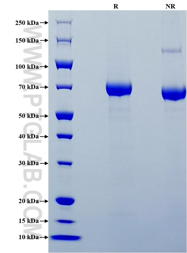 Purity of Recombinant Mouse Endoglin/CD105 was determined by SDS-PAGE. The protein was resolved in an SDS-PAGE in reducing (R) and non-reducing (NR) conditions and stained using Coomassie blue.