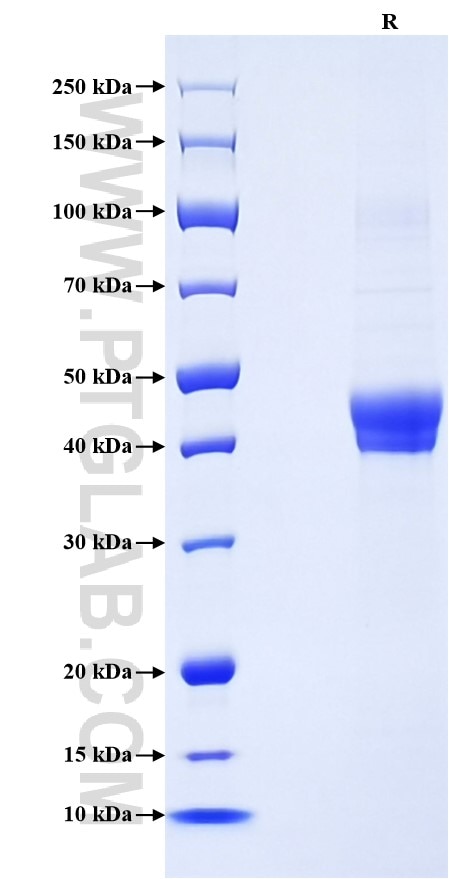Purity of Recombinant Human Pentraxin 3 was determined by SDS-PAGE. The protein was resolved in an SDS-PAGE in reducing (R) conditions and stained using Coomassie blue.
