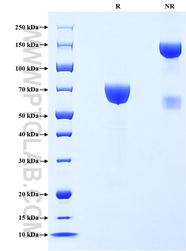 Purity of Recombinant Human IL-21R was determined by SDS-PAGE. The protein was resolved in an SDS-PAGE in reducing (R) and non-reducing (NR) conditions and stained using Coomassie blue. Purity of Recombinant Human IL-21R was determined by SDS-PAGE. The protein was resolved in an SDS-PAGE in reducing (R) and non-reducing (NR) conditions and stained using Coomassie blue.