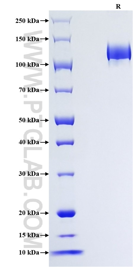 Purity of Recombinant Mouse DPP4 was determined by SDS-PAGE. The protein was resolved in an SDS-PAGE in reducing (R) conditions and stained using Coomassie blue. Purity of Recombinant Mouse DPP4 was determined by SDS-PAGE. The protein was resolved in an SDS-PAGE in reducing (R) conditions and stained using Coomassie blue.
