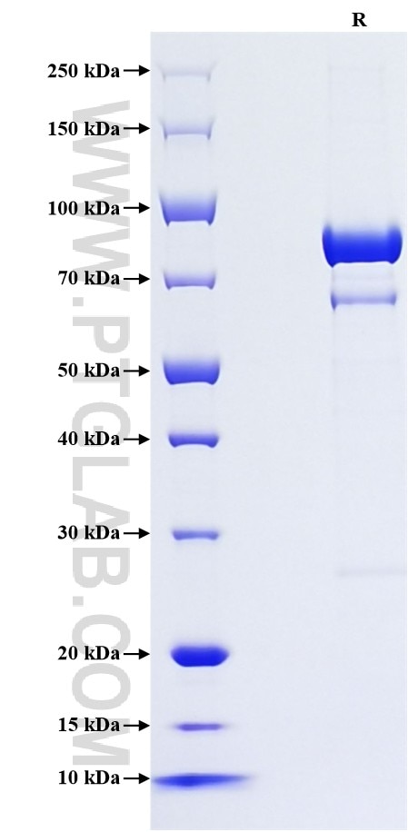 Purity of Recombinant Mouse 5'-Nucleotidase was determined by SDS-PAGE. The protein was resolved in an SDS-PAGE in reducing (R) conditions and stained using Coomassie blue.