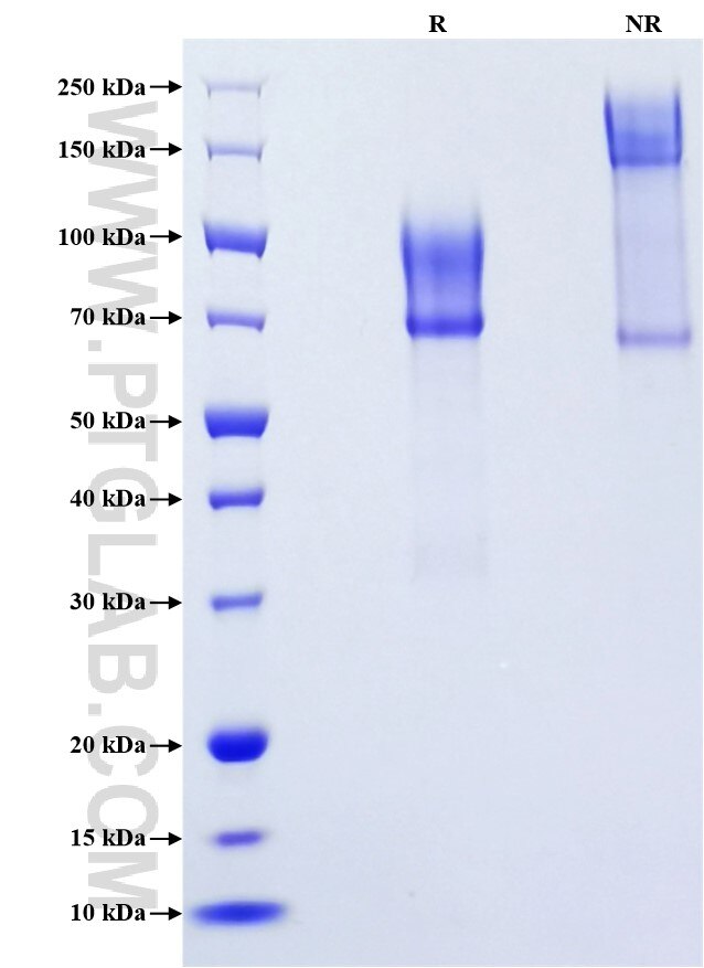 Purity of Recombinant Mouse CD43 was determined by SDS-PAGE. The protein was resolved in an SDS-PAGE in reducing (R) and non-reducing (NR) conditions and stained using Coomassie blue.