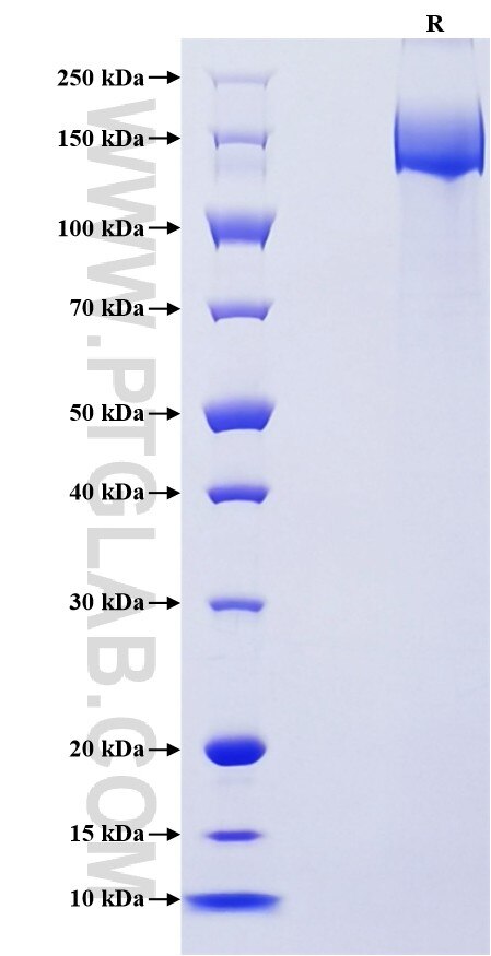 Purity of Recombinant Mouse CD21 was determined by SDS-PAGE. The protein was resolved in an SDS-PAGE in reducing (R) conditions and stained using Coomassie blue. Purity of Recombinant Mouse CD21 was determined by SDS-PAGE. The protein was resolved in an SDS-PAGE in reducing (R) conditions and stained using Coomassie blue.