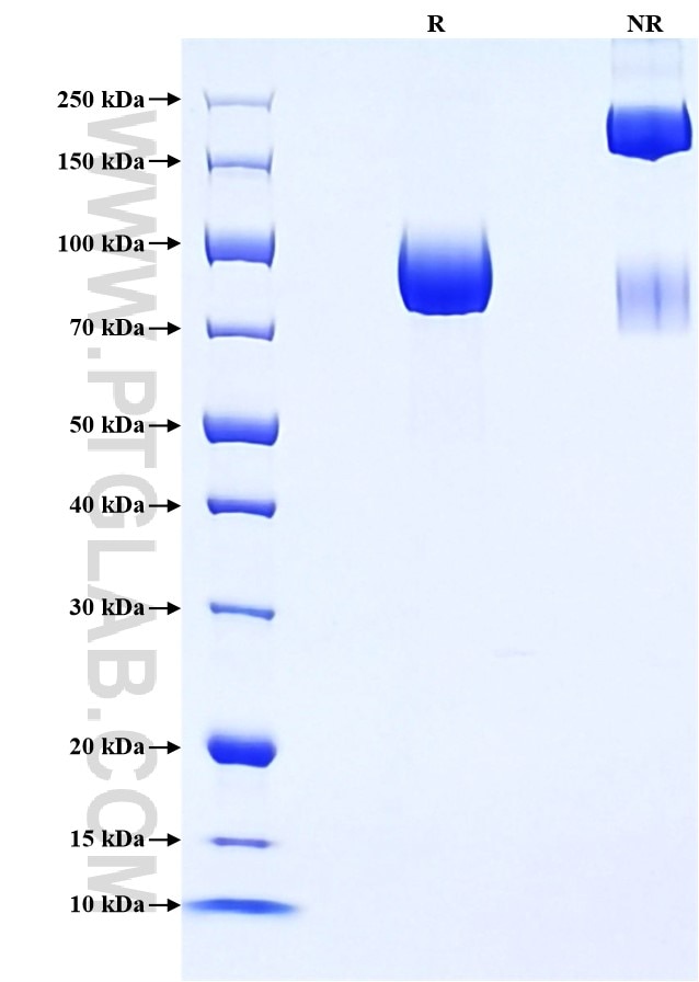 Purity of Recombinant Mouse CD6 was determined by SDS-PAGE. The protein was resolved in an SDS-PAGE in reducing (R) and non-reducing (NR) conditions and stained using Coomassie blue.