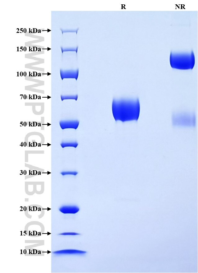 Purity of Recombinant Mouse CD2 was determined by SDS-PAGE. The protein was resolved in an SDS-PAGE in reducing (R) and non-reducing (NR) conditions and stained using Coomassie blue.