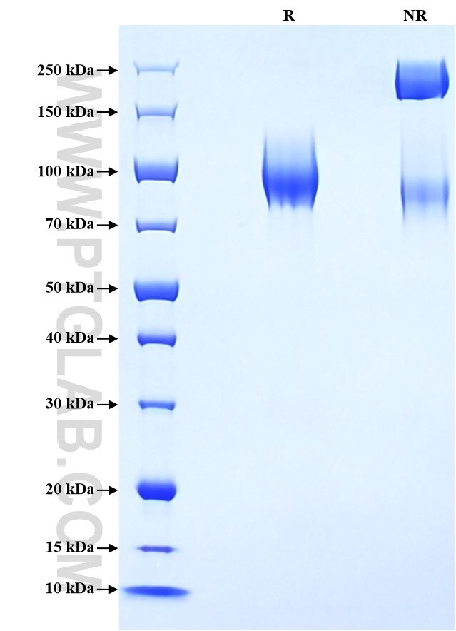 Purity of Recombinant Mouse CEACAM-1 was determined by SDS-PAGE. The protein was resolved in an SDS-PAGE in reducing (R) and non-reducing (NR) conditions and stained using Coomassie blue.