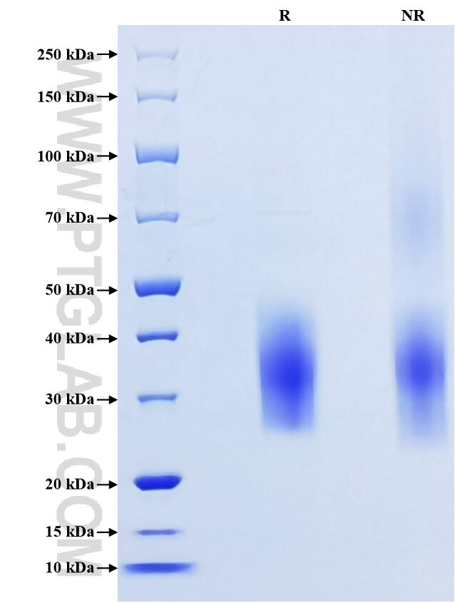 Purity of Recombinant Human TREM-1 was determined by SDS-PAGE. The protein was resolved in an SDS-PAGE in reducing (R) and non-reducing (NR) conditions and stained using Coomassie blue.