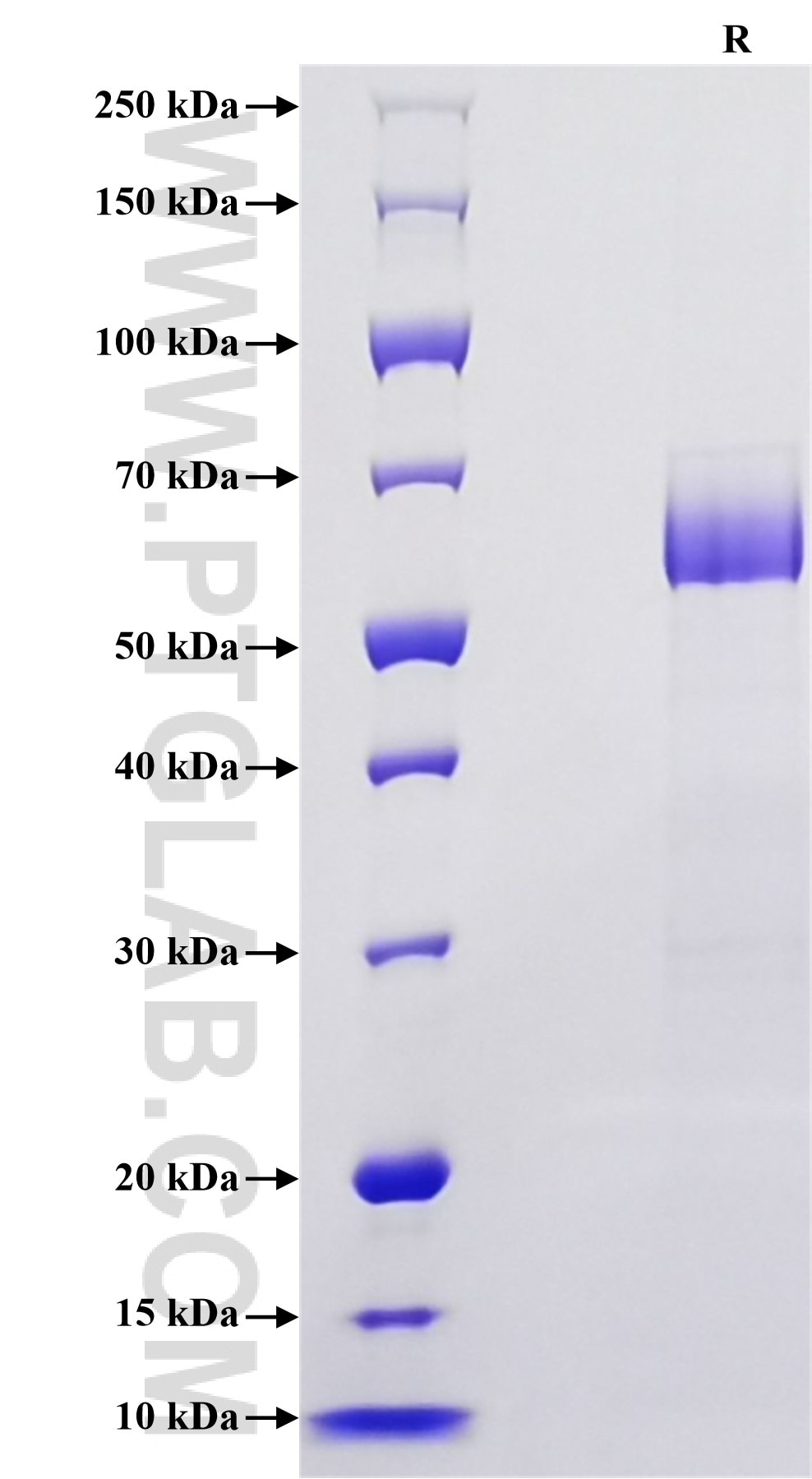 Purity of Recombinant Rat CD25 was determined by SDS-PAGE. The protein was resolved in an SDS-PAGE in reducing (R) conditions and stained using Coomassie blue.