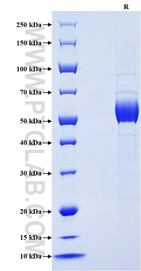 Purity of Recombinant Rat KLRB1A was determined by SDS-PAGE. The protein was resolved in an SDS-PAGE in reducing (R) conditions and stained using Coomassie blue. Purity of Recombinant Rat KLRB1A was determined by SDS-PAGE. The protein was resolved in an SDS-PAGE in reducing (R) conditions and stained using Coomassie blue.
