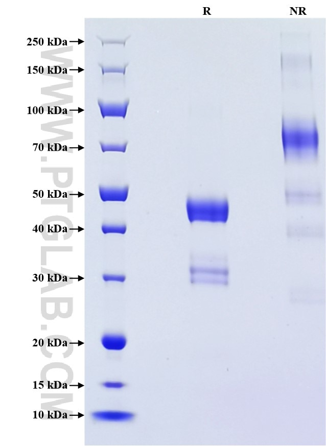 Purity of Recombinant Human VEGF-C was determined by SDS-PAGE. The protein was resolved in an SDS-PAGE in reducing (R) and non-reducing (NR) conditions and stained using Coomassie blue. Purity of Recombinant Human VEGF-C was determined by SDS-PAGE. The protein was resolved in an SDS-PAGE in reducing (R) and non-reducing (NR) conditions and stained using Coomassie blue.