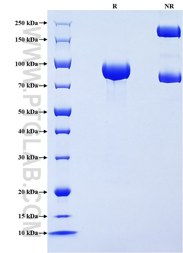 Purity of Recombinant Human Alpha 1B-Glycoprotein
 was determined by SDS-PAGE. The protein was resolved in an SDS-PAGE in reducing (R) and non-reducing (NR) conditions and stained using Coomassie blue.