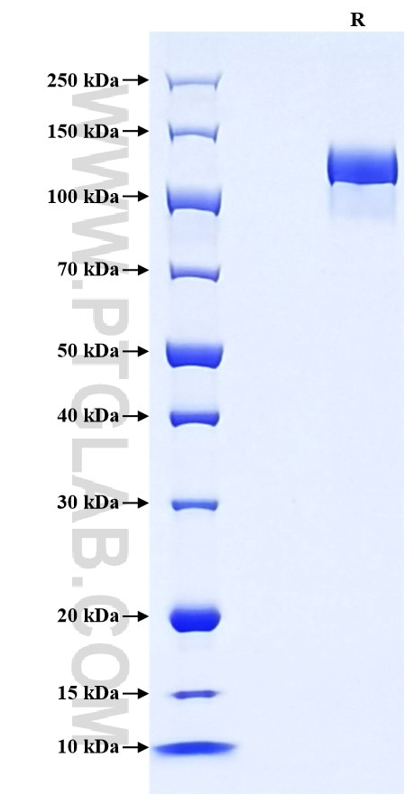 Purity of Recombinant Mouse Tie-2 was determined by SDS-PAGE. The protein was resolved in an SDS-PAGE in reducing (R) conditions and stained using Coomassie blue.