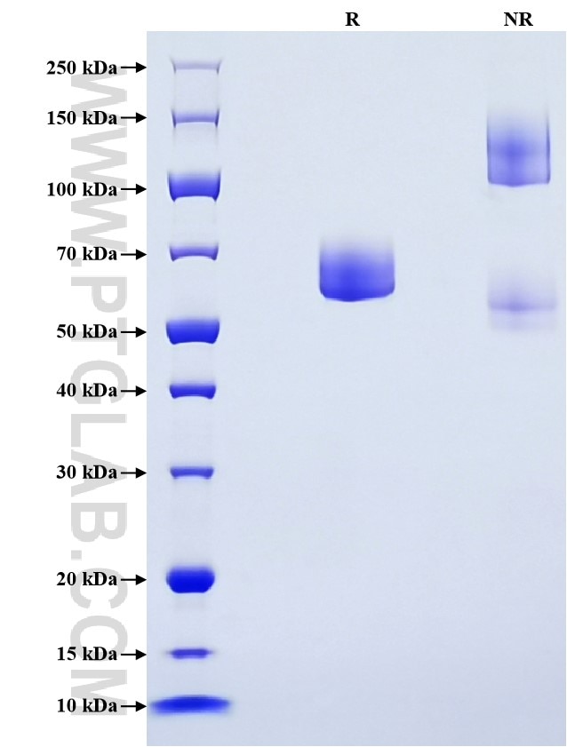 Purity of Recombinant Mouse EPCR was determined by SDS-PAGE. The protein was resolved in an SDS-PAGE in reducing (R) and non-reducing (NR) conditions and stained using Coomassie blue.