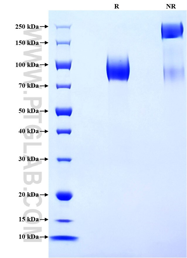 Purity of Recombinant Mouse SIRP alpha was determined by SDS-PAGE. The protein was resolved in an SDS-PAGE in reducing (R) and non-reducing (NR) conditions and stained using Coomassie blue.