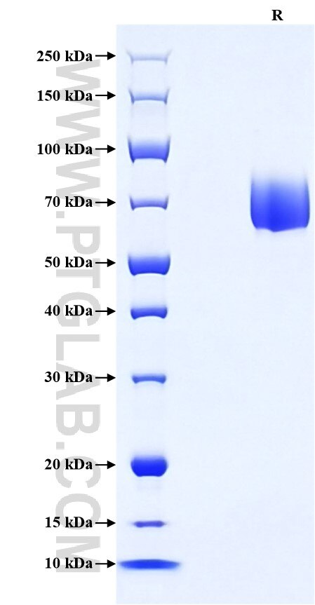Purity of Recombinant Mouse ALCAM was determined by SDS-PAGE. The protein was resolved in an SDS-PAGE in reducing (R) conditions and stained using Coomassie blue.